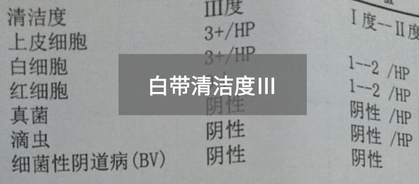 今天快訊！全自動白帶麻豆福利导航生產廠家麻豆AV在线电影為您官方解釋白帶清潔度3的意思